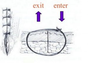 Simple Interrupted Suturing Technique